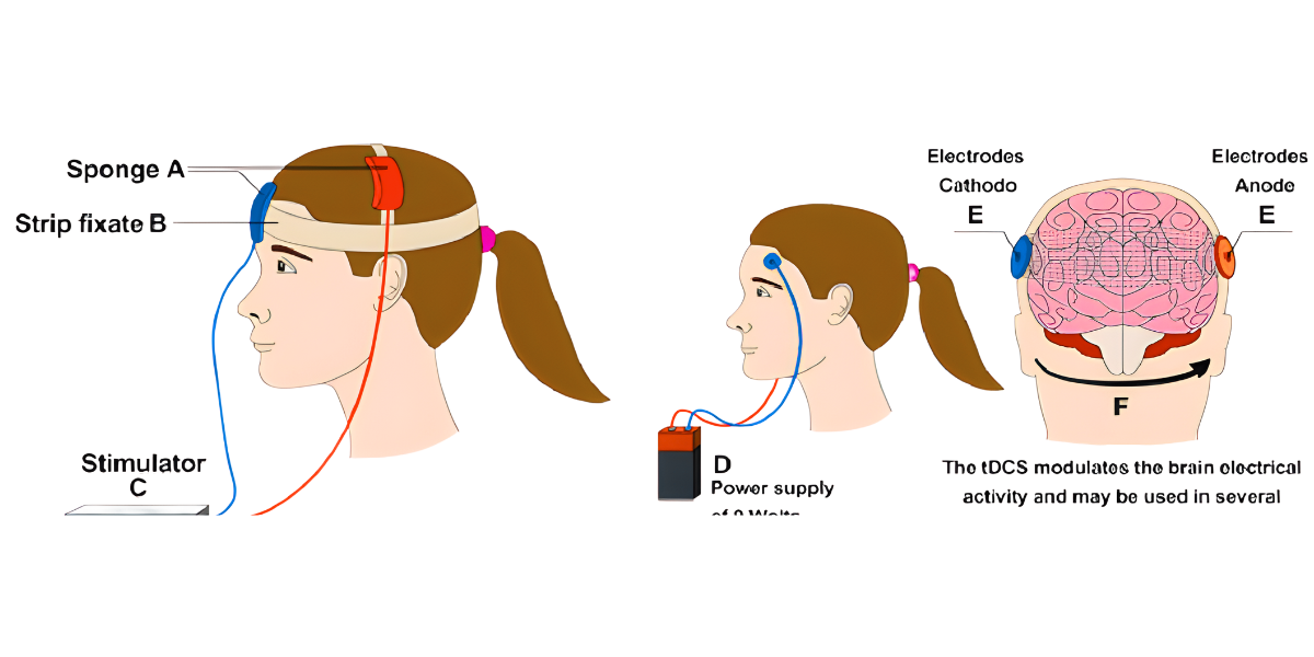 tDCS Karimnagar,brain stimulation therapy Karimnagar,non invasive brain therapy Telangana,depression treatment Karimnagar,anxiety treatment Karimnagar,neuromodulation therapy Karimnagar,Dr L Versi Psychiatrist,Suma Hospital Mental Health,brain stimulation Telangana,cognitive enhancement therapy